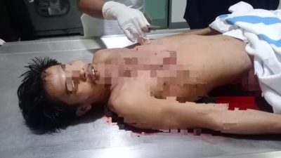 Seorang Kernet Tewas di Pelabuhan Trisakti, Terjepit Truk dan Kontainer